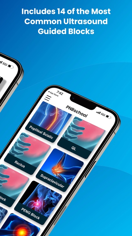 PNBschool Anesthesia Blocks