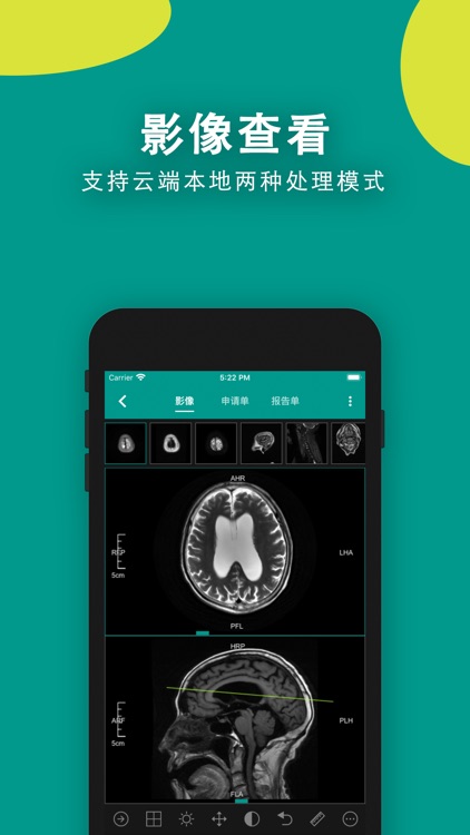 易影-领先的“互联网+医学”影像云平台