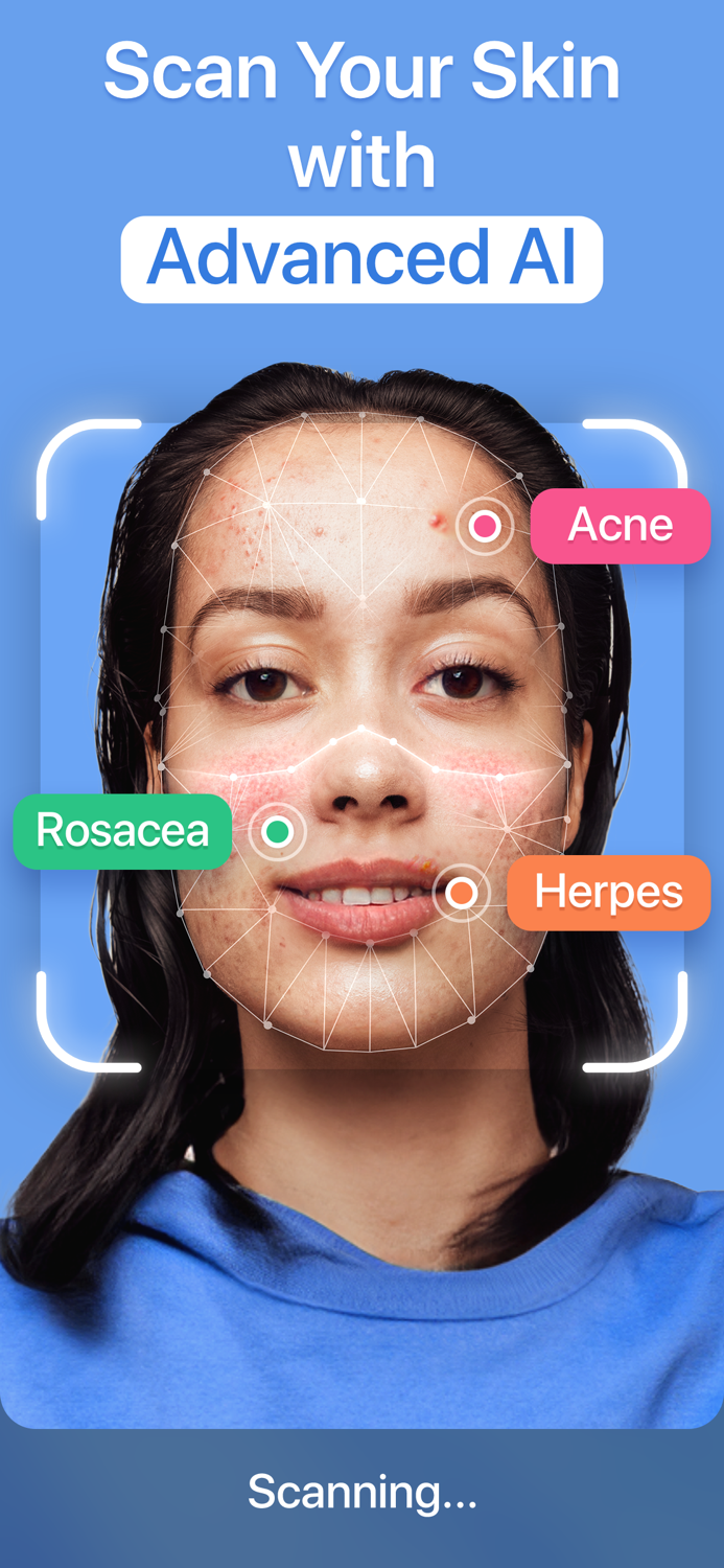 AI Skin Scanner－Scan and Analyze