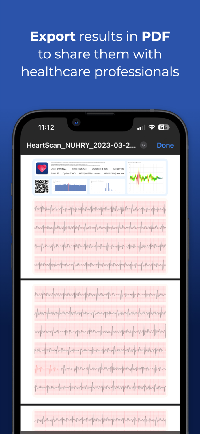 HeartScan Heart Rate Monitor