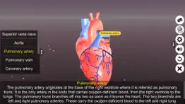 sections of human heart iphone screenshot 4