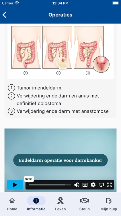 Darmkanker screenshot-4