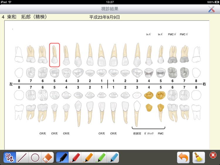 Perio chart Pro.Voice screenshot-3