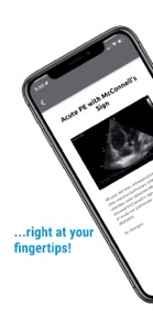 The POCUS Atlas screenshot #2 for iPhone