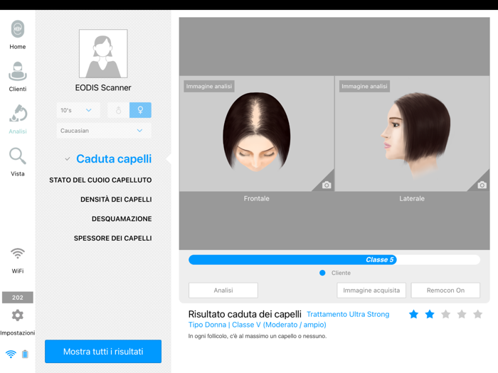 EODIS Hair and Scalp Scanner