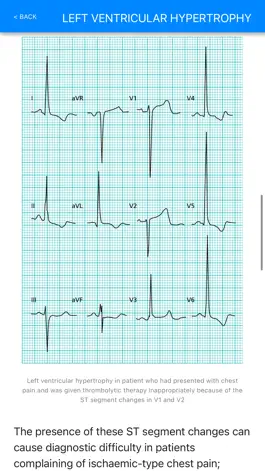 Game screenshot ECG Basics Pro - ECG Made Easy hack