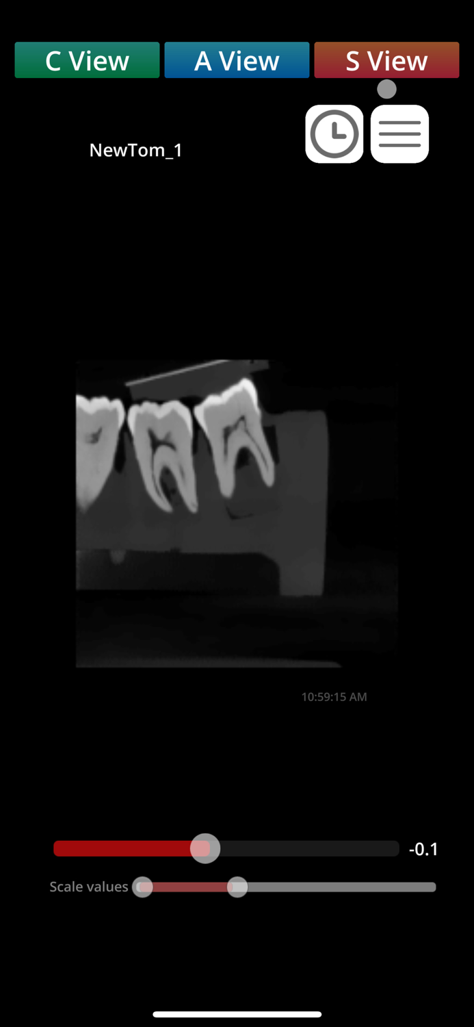 Zumax Dicom Viewer - CN