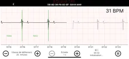 Game screenshot Equimetre ECG apk