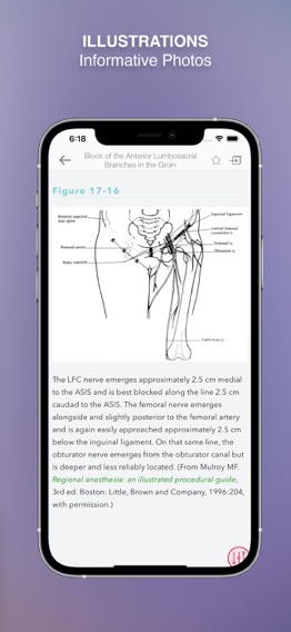 Clinical Anesthesia MGH HBKのおすすめ画像3