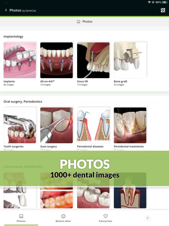 Screenshot #5 pour DentiCalc - the dental app