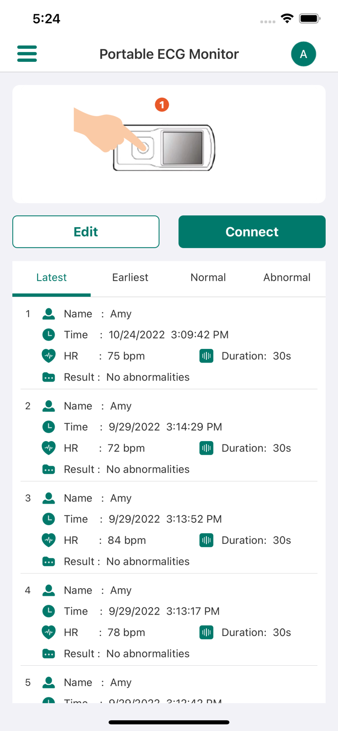 EMAY Portable ECG Monitor