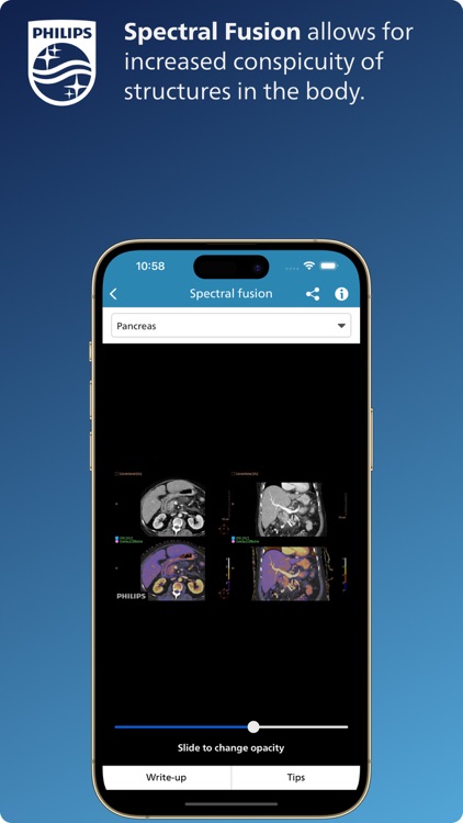 Philips CT Learning screenshot-4