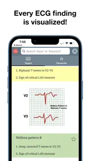 How to cancel & delete ecg stat 3