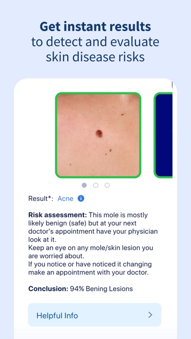 AI Dermatologist: Skin Scanner Screenshot