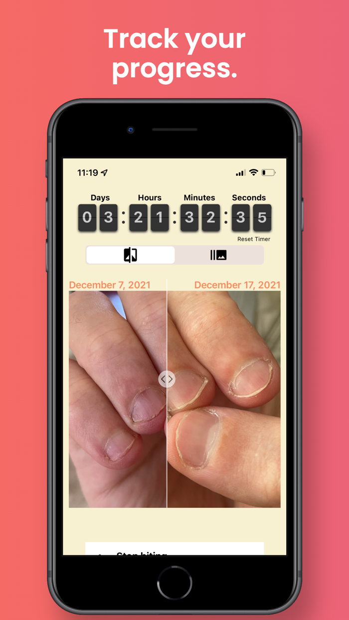 NailKeeper - Stop Biting Nails