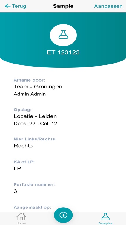 Perfusiesamples niermachines