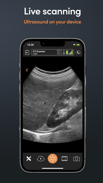 Clarius Ultrasound Appのおすすめ画像2