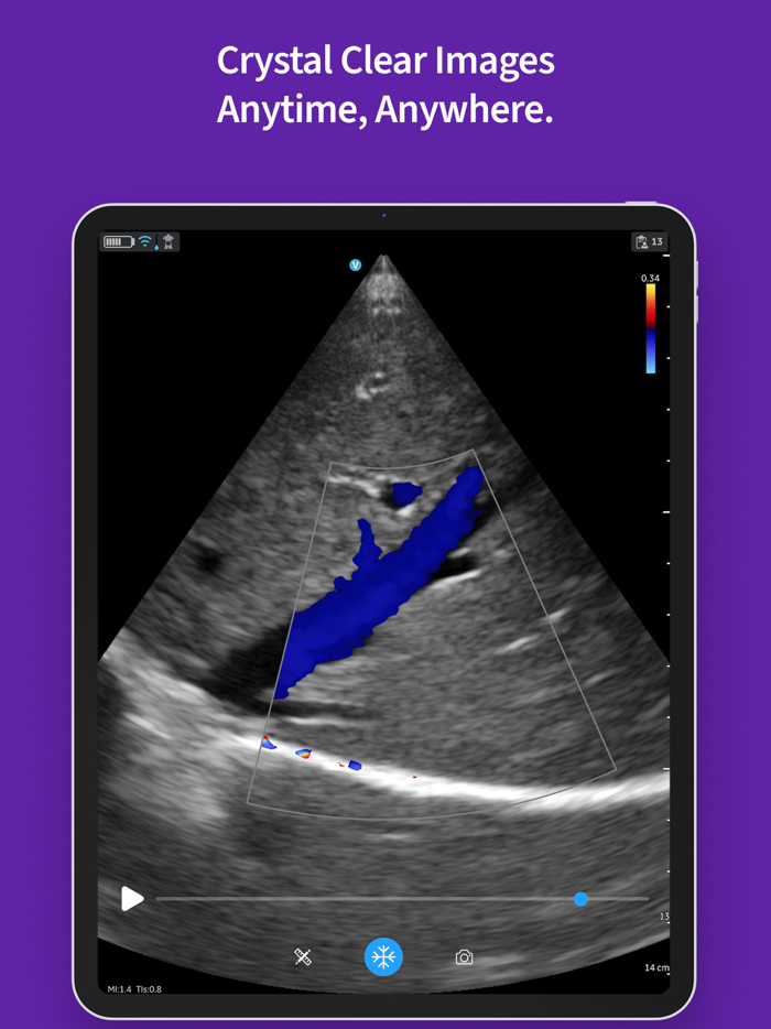 Vscan Air Wireless Ultrasound