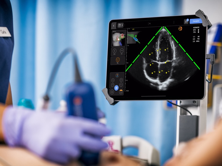 Kosmos Ultrasound