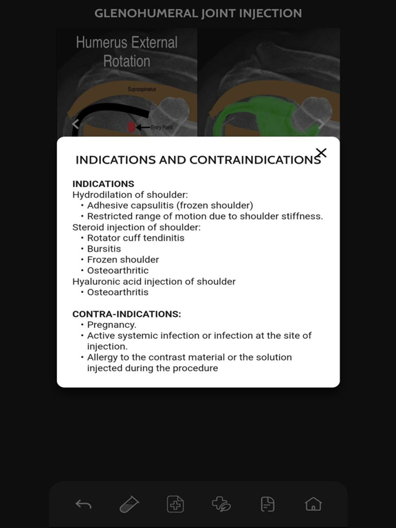 VBS RadGuide: MSK Injections iPad screenshot 5 - Medical app