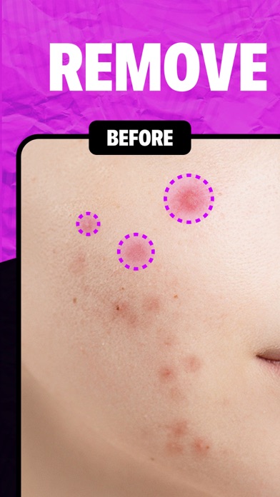 Remove Object & Erase Pimplesのおすすめ画像5