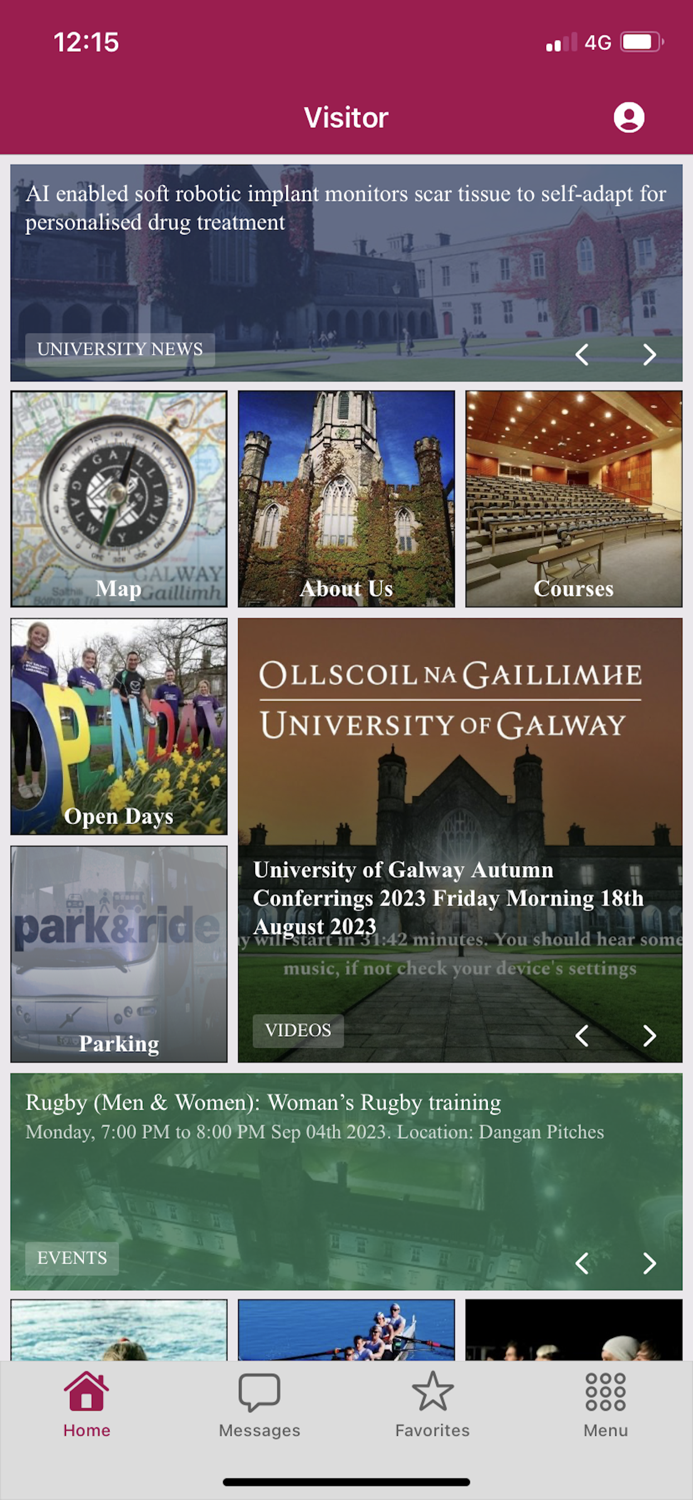 University of Galway