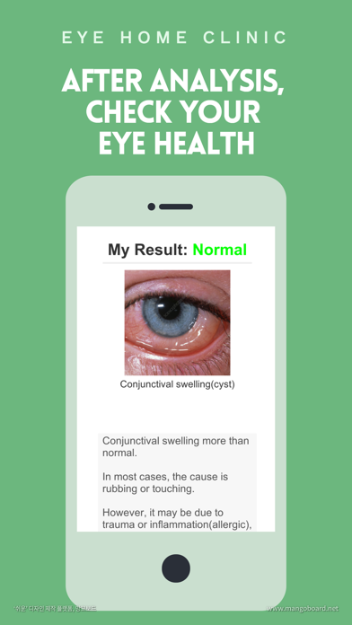 EYE Home Clinic Screenshot