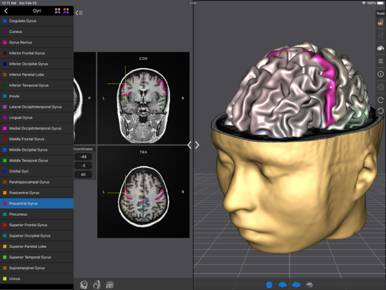 Screenshot #4 pour Brain Tutor 3D