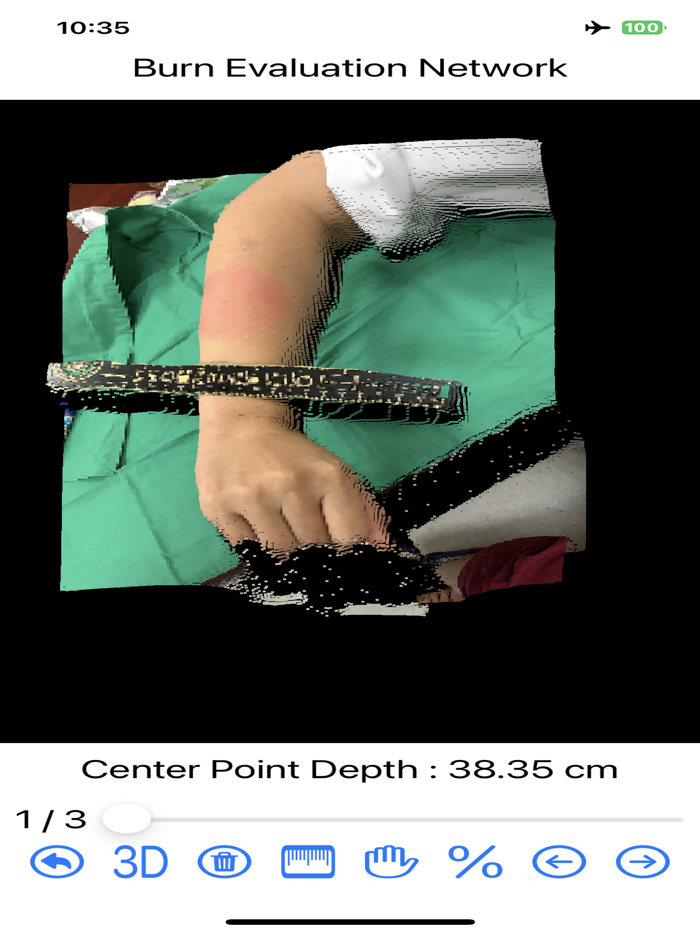 Burn Evaluation Network