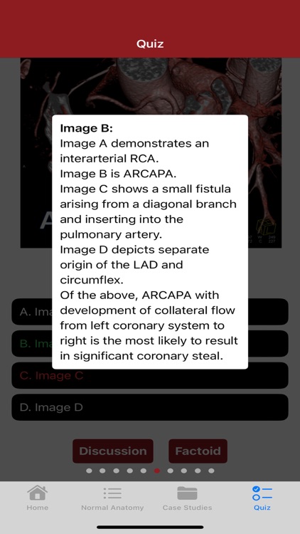 CTisus CT Coronary Arteries screenshot-8