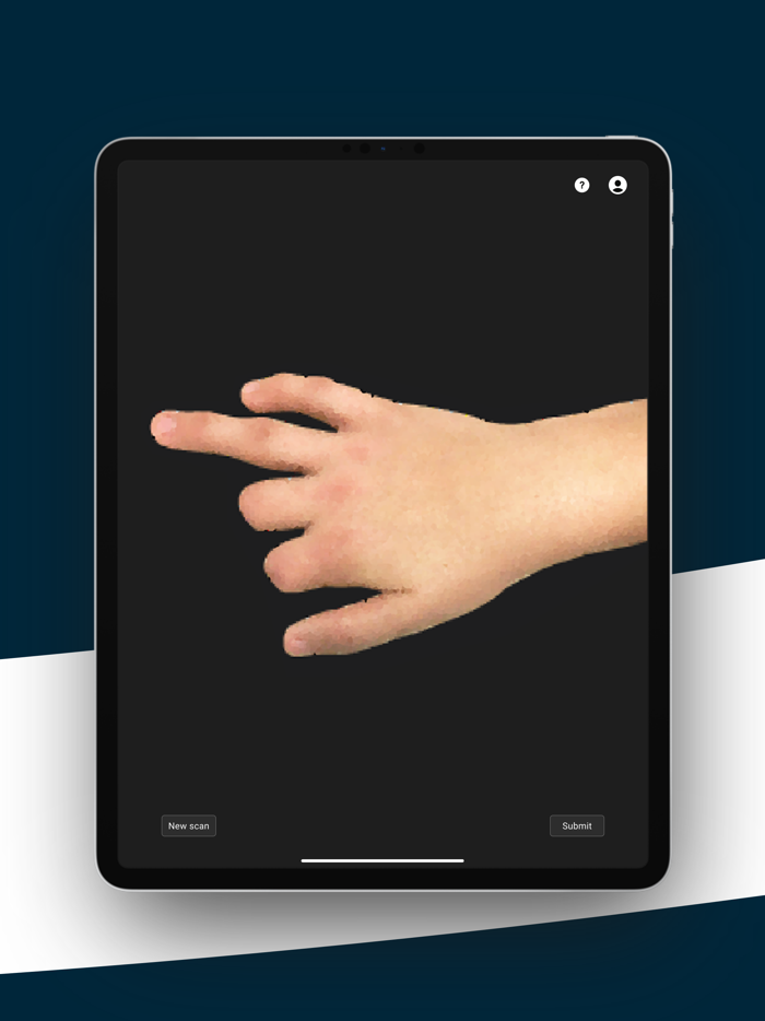 Naked Prosthetics 3D Scanner