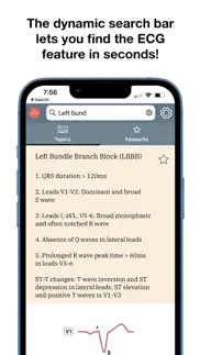 ecg stat iphone screenshot 3