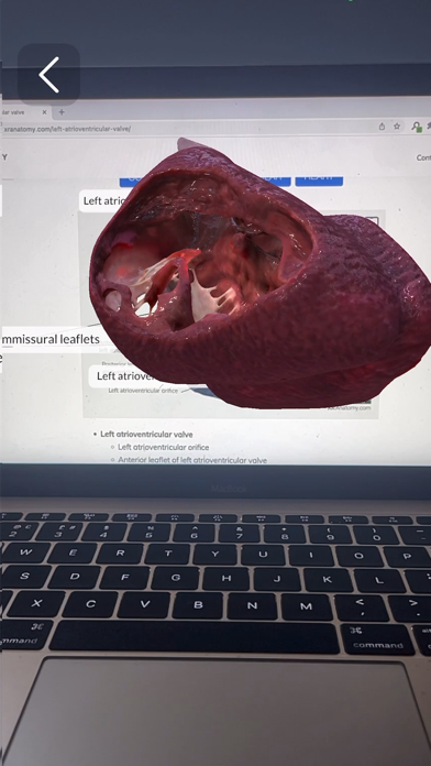 XR Anatomyのおすすめ画像8