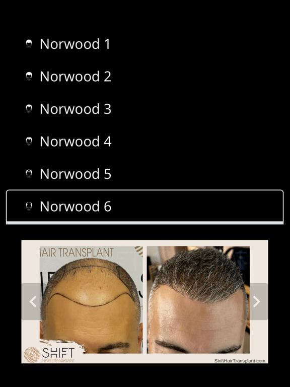 Screenshot #6 pour SHIFT Hair Transplant