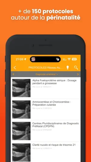 Réseau AURORE - Protocoles screenshot 4