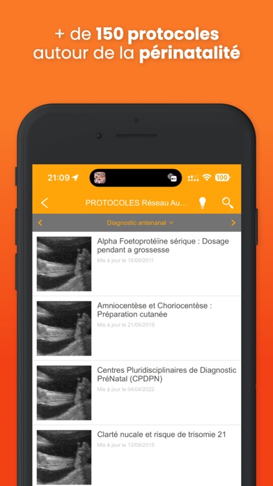 Réseau AURORE - Protocoles Screenshot