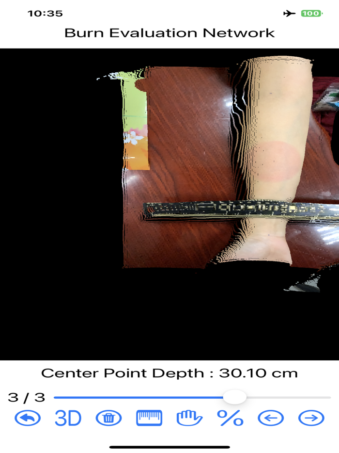 Burn Evaluation Network