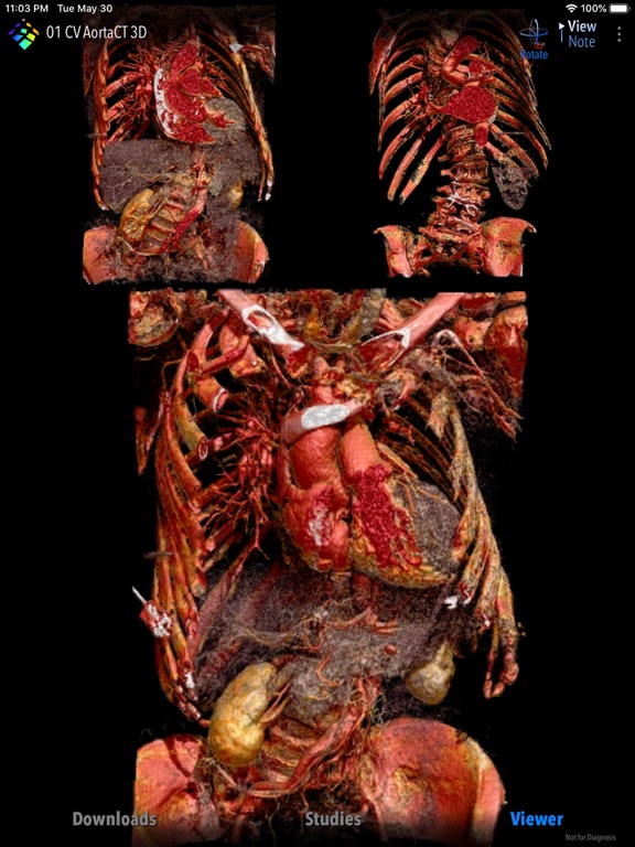 MedVizi™ CT-MRI Viewer iPad screenshot 4 - Medical app