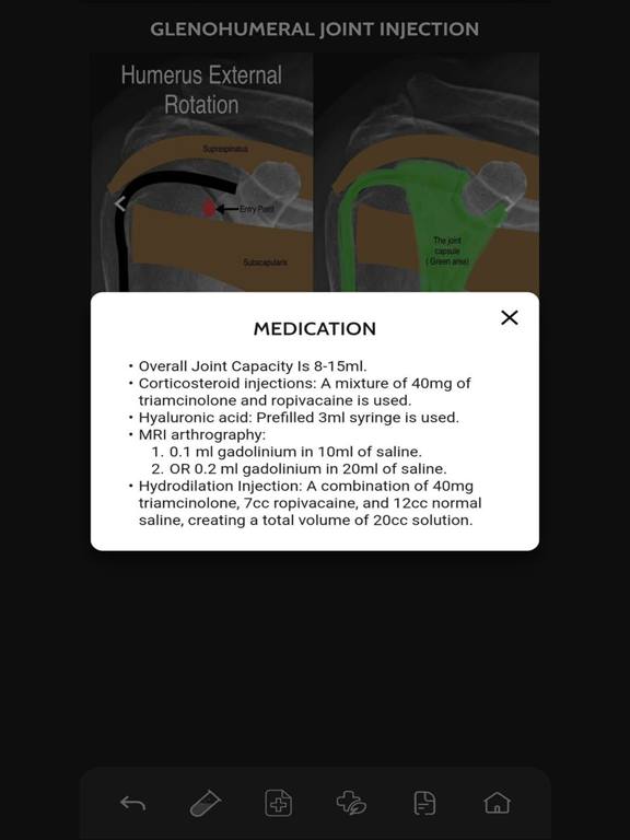 VBS RadGuide: MSK Injections iPad screenshot 6 - Medical app