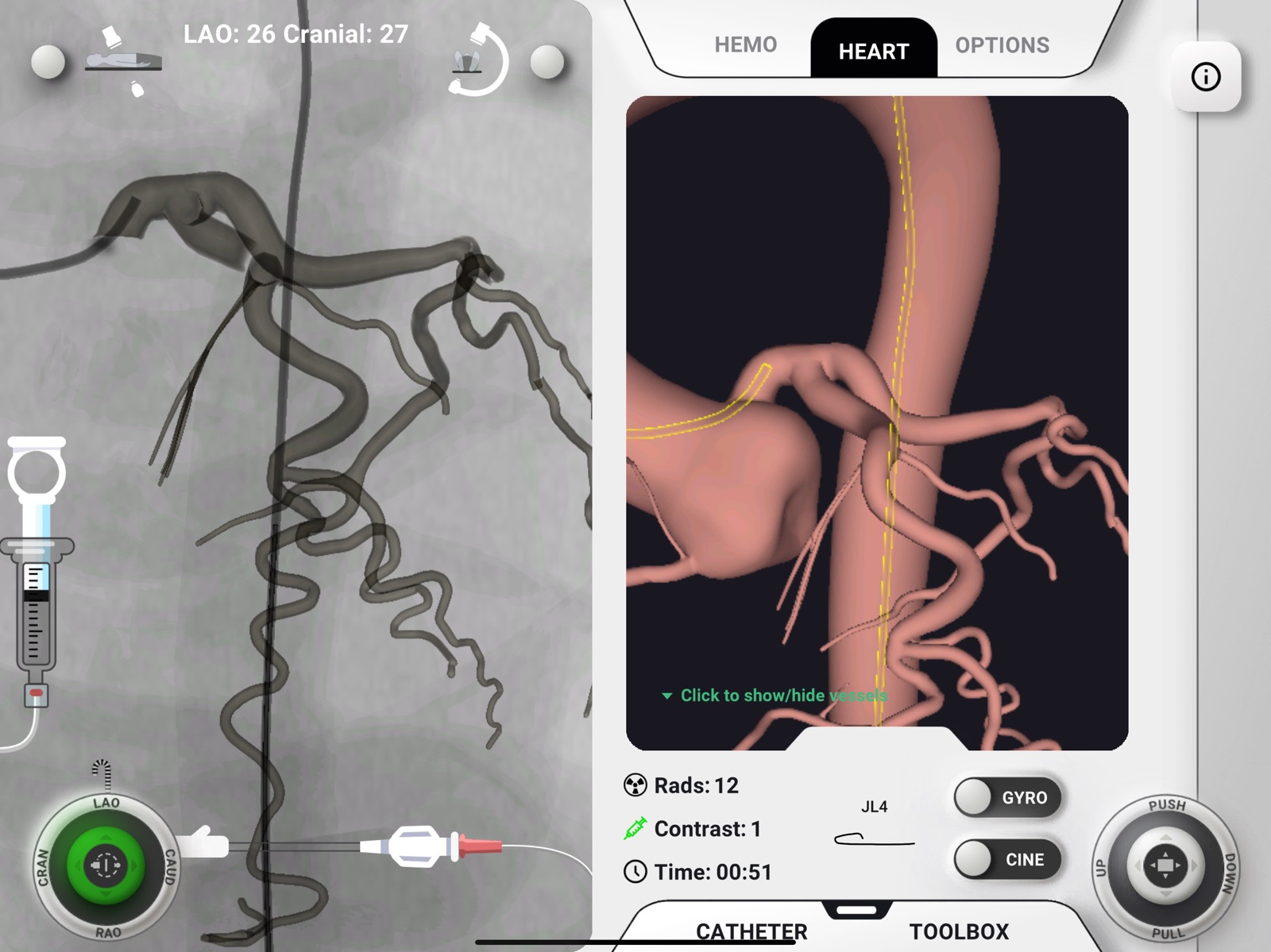 AngioAID 3D ipad screenshot 2