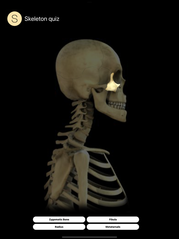 Screenshot #5 pour Human Skeleton Quiz