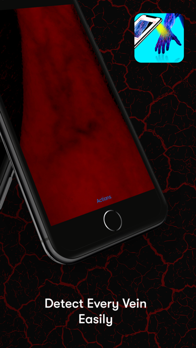 X-Vein Screenshot