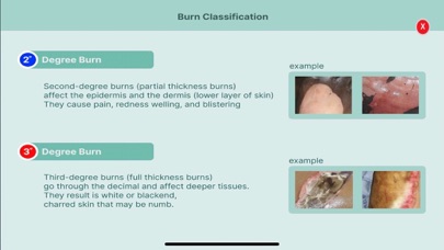 Total Burn Resuscitation Screenshot