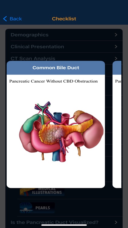 CTisus Pancreas Mass Checklist screenshot-3