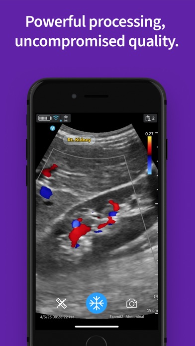Vscan Air VET Ultrasound Screenshot