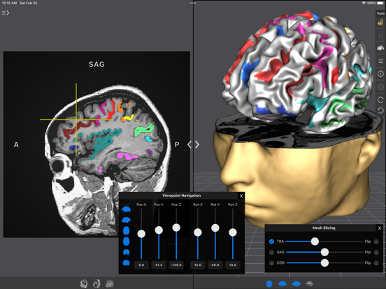 Screenshot #6 pour Brain Tutor 3D