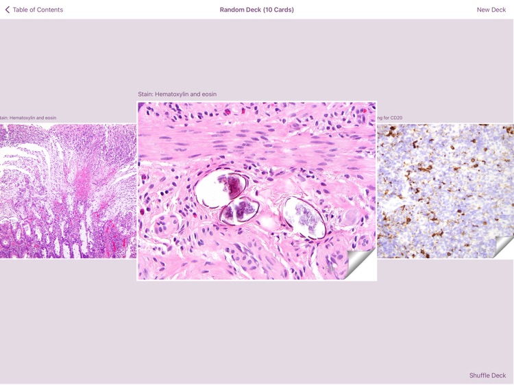 Colonic Pathology screenshot-4