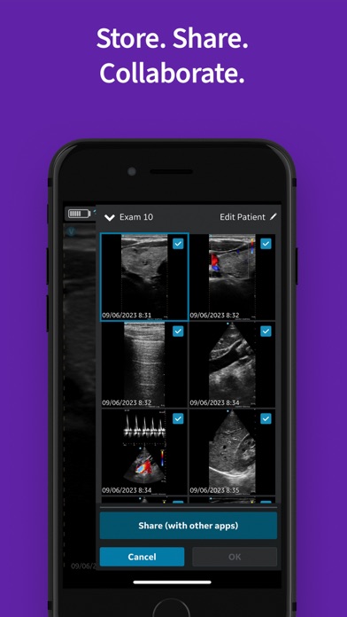 Vscan Air VET Ultrasound Screenshot
