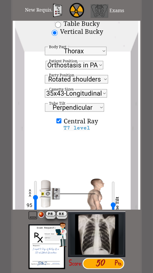 #1. Radiology Technique Simulator (iOS) 由: Italo Roger Melo Sales