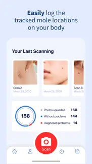 ai dermatologist: skin scanner iphone screenshot 3